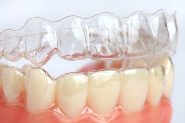 Alignment Issues When Clear Aligners Are Recommended